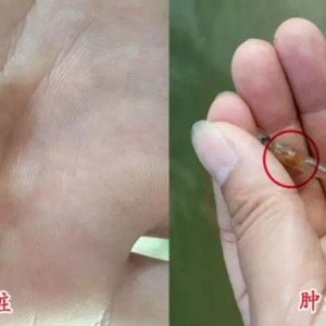 �������еı��ζ������ⶾ���J�屣���`�^(q��)��